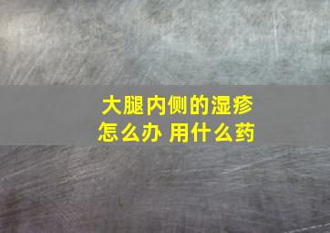 大腿内侧的湿疹怎么办 用什么药